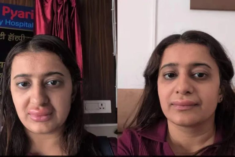വന്ദേഭാരതിലെ ഭക്ഷണം 'ഹാനികരമോ'? കഴിച്ചതിന് പിന്നാലെ യുവതിക്ക് ഗുരുതര അലര്‍ജിയും കുഞ്ഞിന് വയറിളക്കവുമെന്നും ആരോപണം; എല്ലാം തള്ളി ഐആര്‍സിടിസി; ഇത് ഗൗരവത്തില്‍ എടുക്കേണ്ട വീഡിയോ